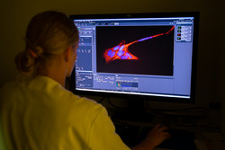 Multiplex Immunoassay