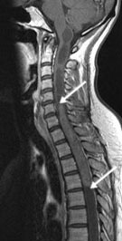 Wie Sieht Ein Tumor Aus Bilder